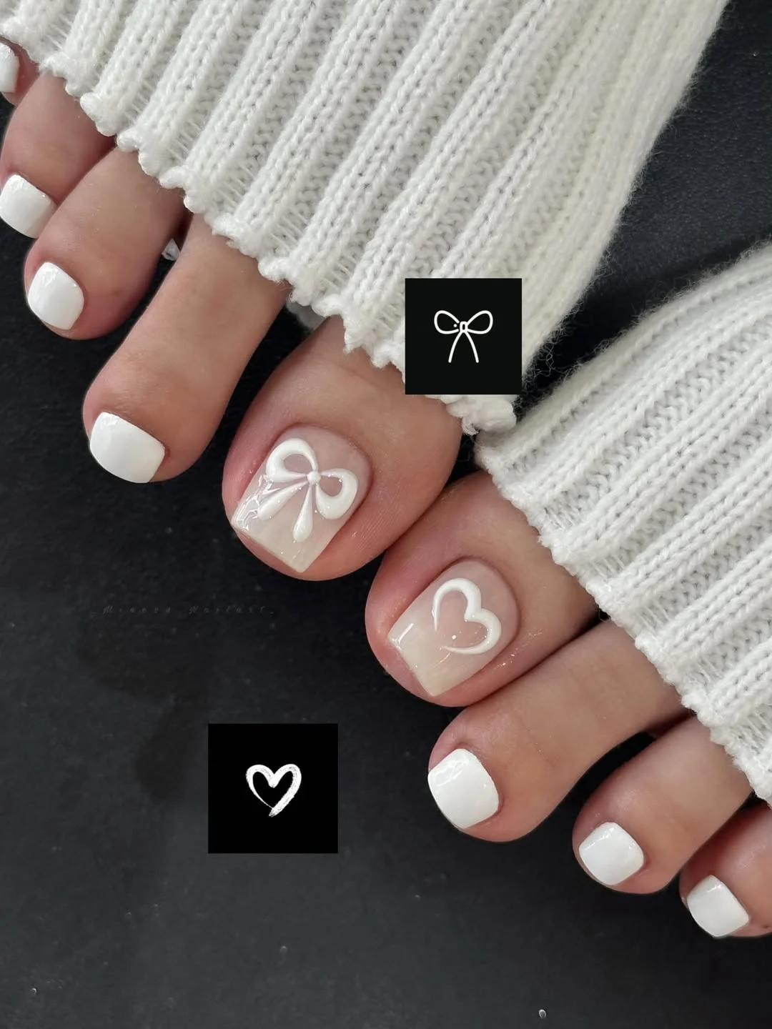 19 June pedicure ideas 2026 Sweet White Bow Pedicure with Romantic Charm